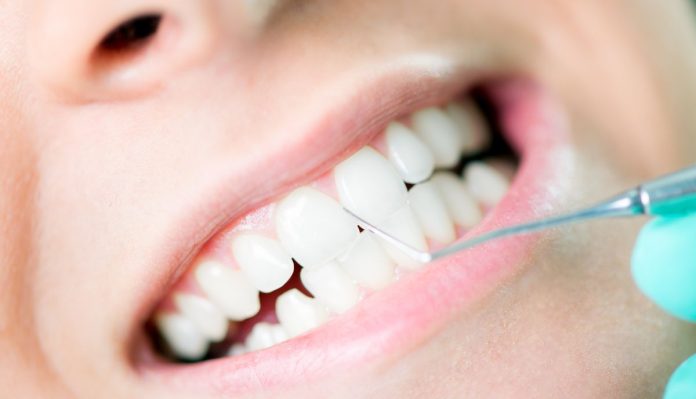 How To Clean Dental Appliances?`